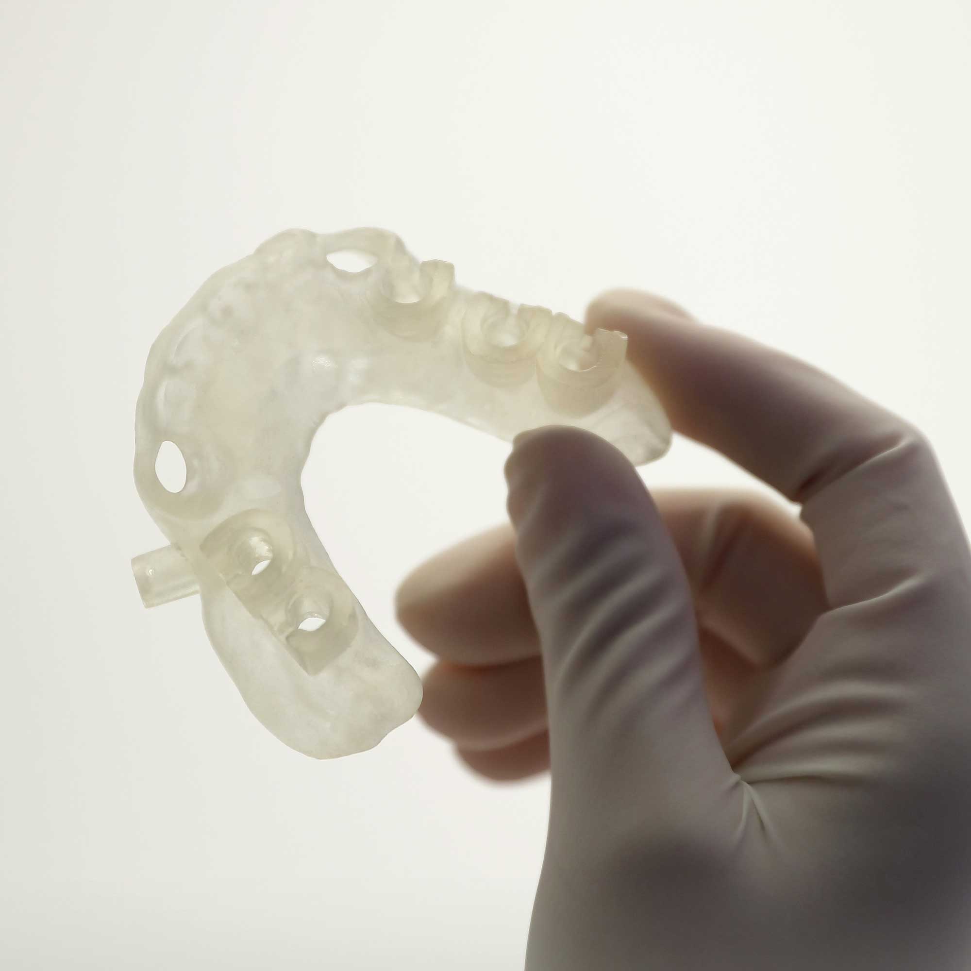 Dłoń trzymająca stomatologiczny szablon chirurgiczny wyprodukowany za pmocą drukarki 3D