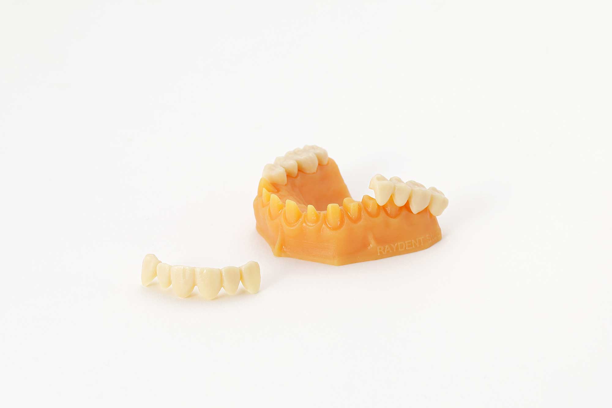 Tymczasowy mosty stomatologiczne nałożone na model zębów