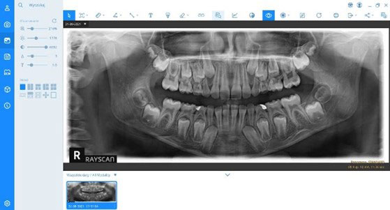 oprogramowanie dla dentystow smartdent v3 do zarzadzania baza zdjec i badan 2d