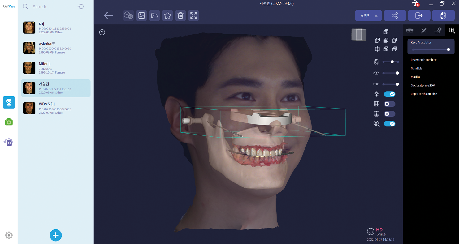 Pacjentka podczas skanowania twarzy 3D skanerem RAYFace z widokiem na oprogramowanie