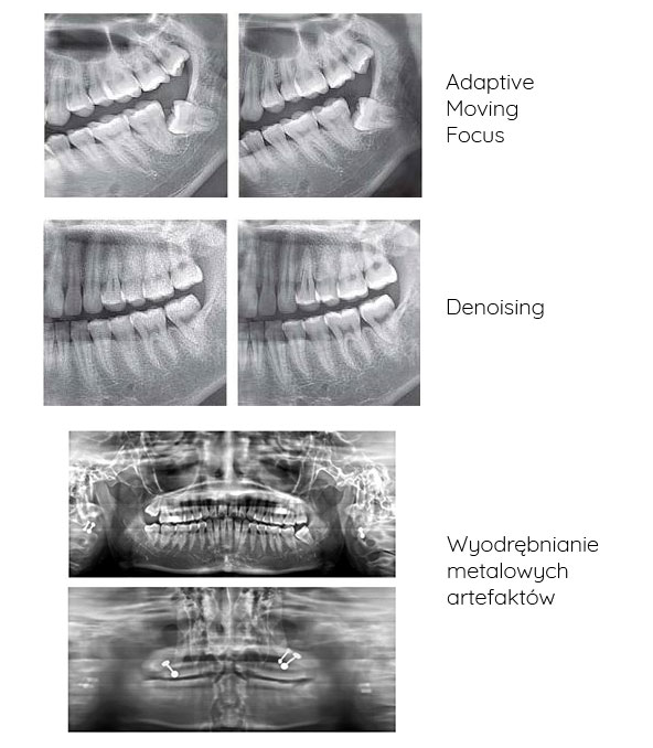 rayscan pantomograf technologie
