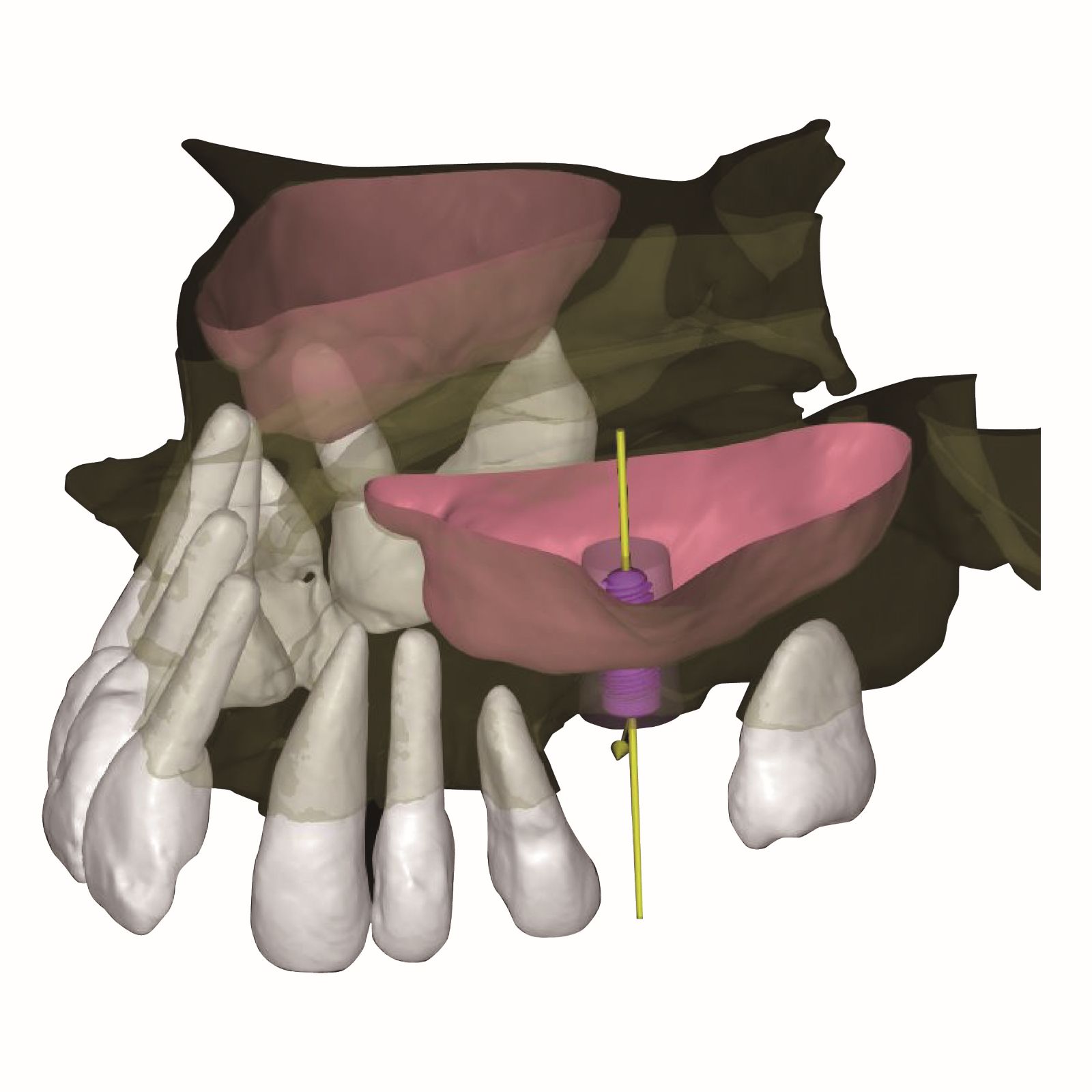 smartdent5D czym jest