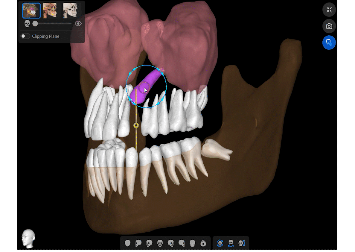 smartdent5D ruch zebow_1