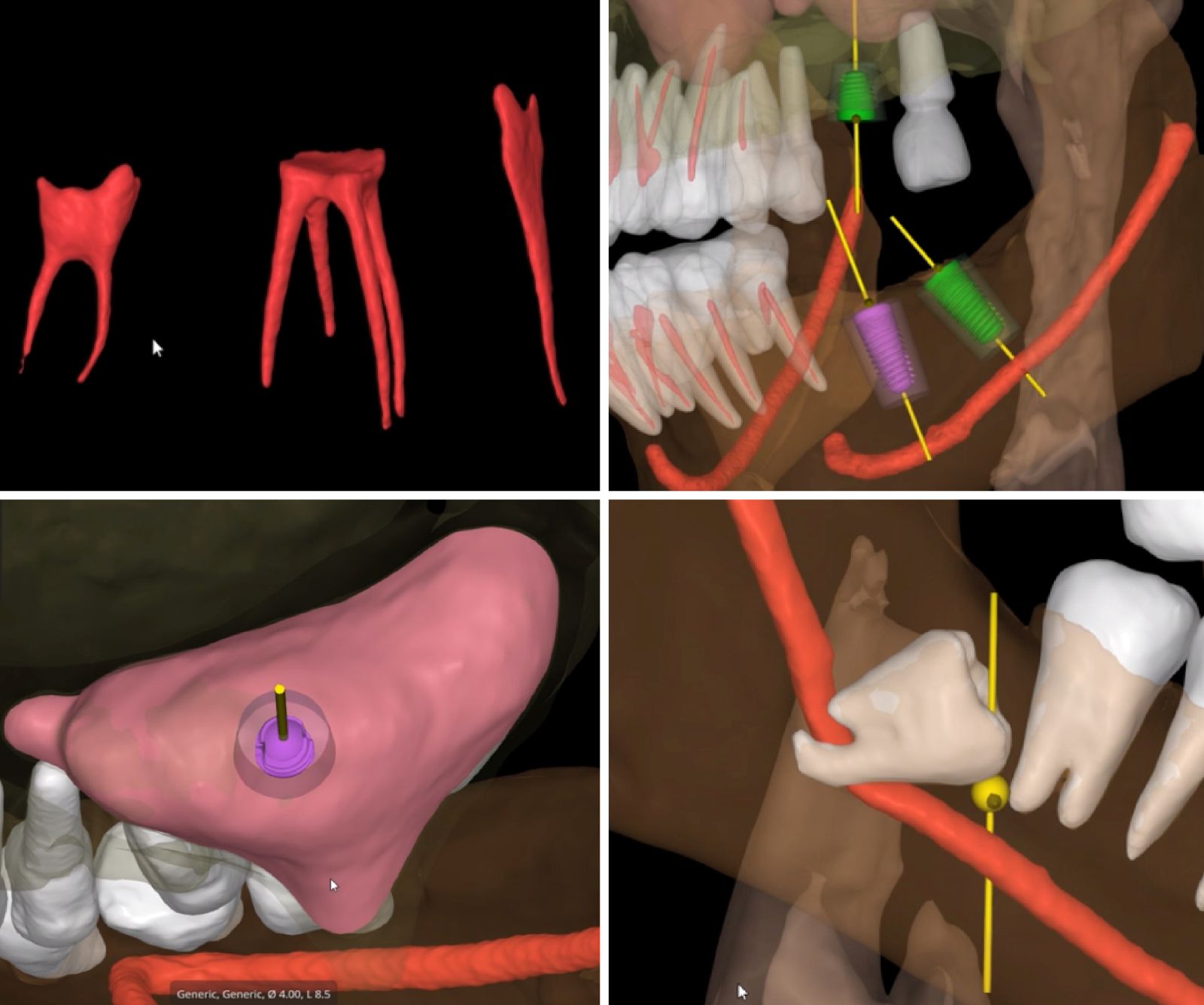 smartdent5D zastosowanie
